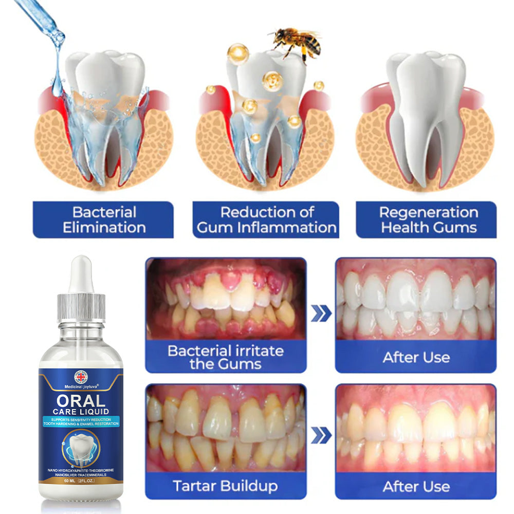 🦷💧Oral Care Liquid– Effectively treats enamel damage, gum inflammation, toothaches, sensitive teeth, gum bleeding, periodontitis, cavities, mouth ulcers, and bad breath.