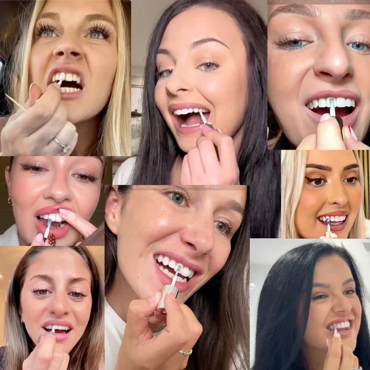 🆙🦷Instant Teeth Whitening Polish  - Enamel Safe Tooth Gloss for Yellow Teeth Stain Removal - Fluoride-Free & Sensitivity Free